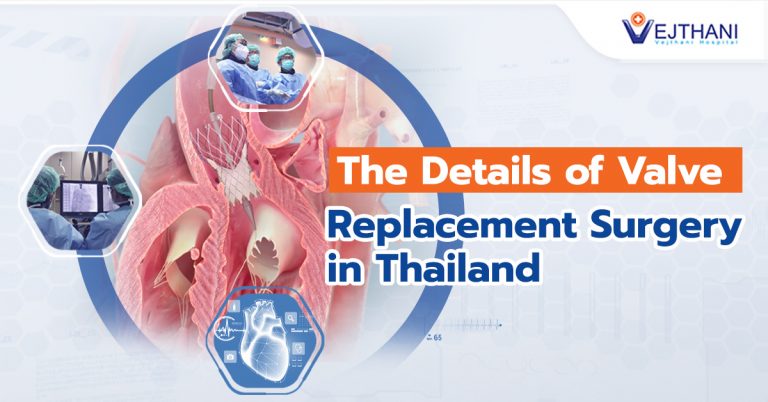 Diagram of a heart showing the location and process of valve replacement surgery.