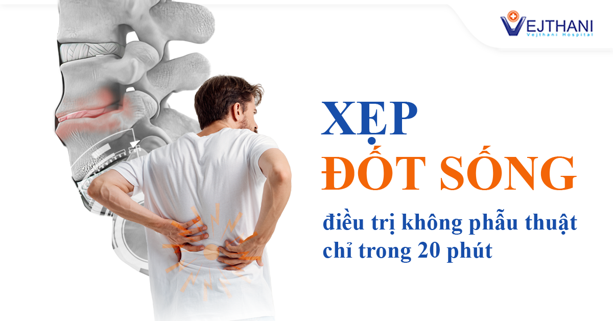 Xẹp đốt sống – Điều trị không cần phẫu thuật chỉ trong 20 phút