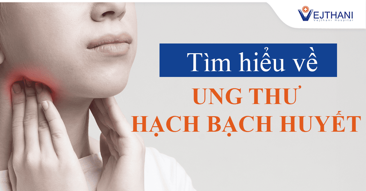 Ung thư hạch bạch huyết là gì, triệu chứng và phương pháp điều trị?